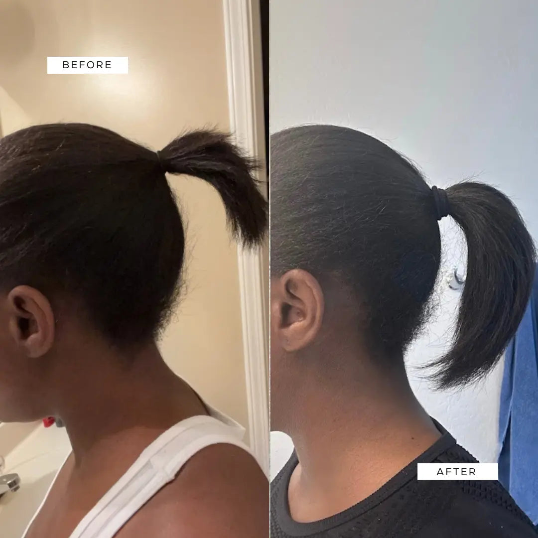 Crown Renewal Scalp & Growth Duo Crown Renewal