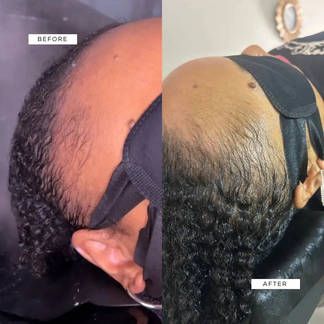 Crown Renewal Scalp & Growth Duo Crown Renewal