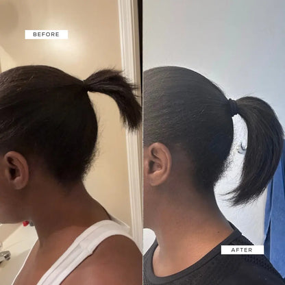 Crown Renewal Scalp & Growth Duo Crown Renewal