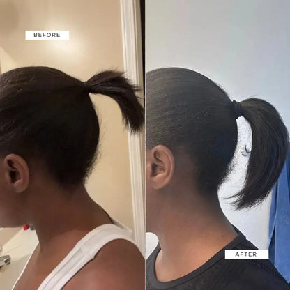 Crown Renewal Scalp & Growth Duo Crown Renewal